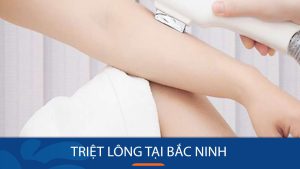 Triệt lông tại Bắc Ninh ở địa chỉ Uy Tín – Chất lượng