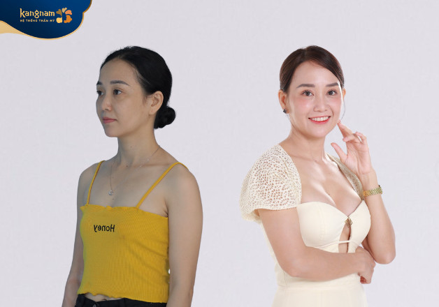 Mẹ đơn thân vượt qua sợ hãi để “tân trang” bản thân