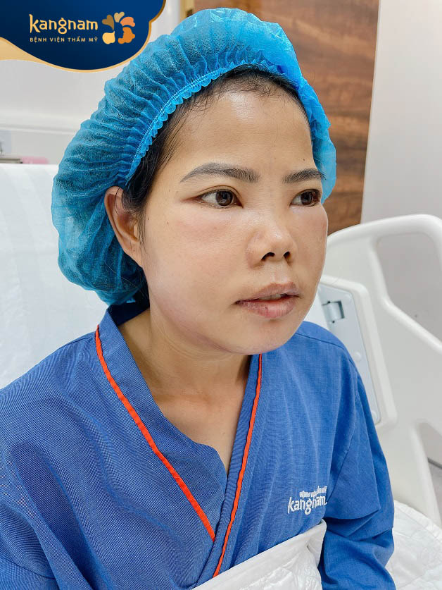 Nguyễn Thị Nhì 2 ngày sau phẫu thuật