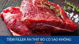 Tiêm filler ăn thịt bò có sao không? Lưu ý về chế độ ăn uống sau khi tiêm filler