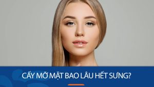 Cấy mỡ mặt bao lâu hết sưng? Cách giảm sưng sau khi cấy mỡ