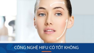 Công nghệ HIFU phù hợp với ai? Lưu ý gì trước khi thực hiện?