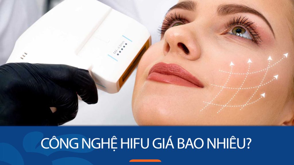Giá Hifu mới nhất  – Chi tiết chi phí từng vùng điều trị
