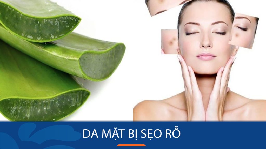 Bí quyết đánh bay sẹo rỗ tận gốc, lấy lại làn da mịn màng