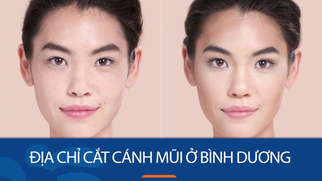 Địa chỉ cắt cánh mũi ở Bình Dương – Dáng mũi cân đối, tự nhiên