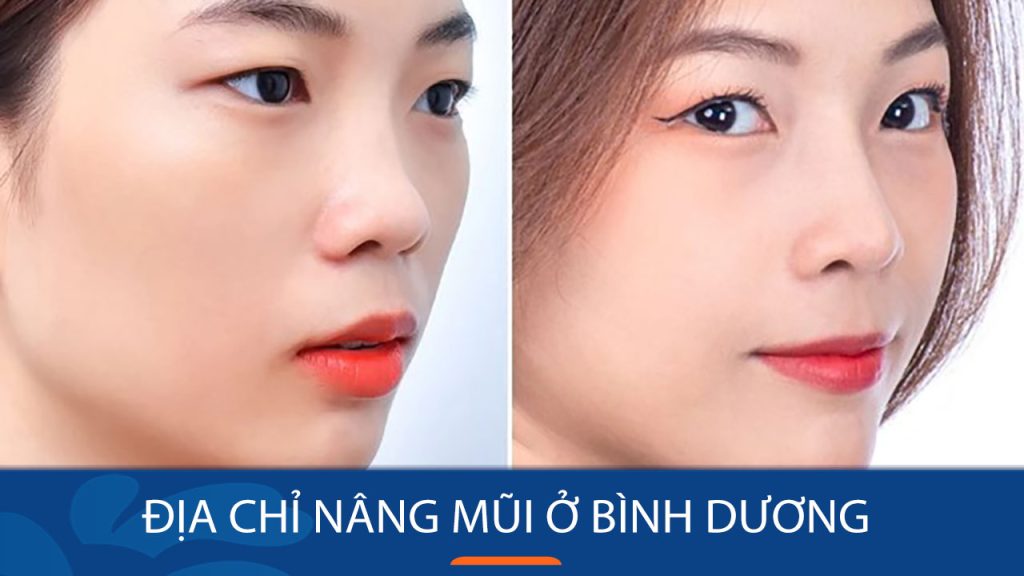 Địa chỉ nâng mũi ở Bình Dương giúp bạn sở hữu dáng mũi cao, đẹp tự nhiên!