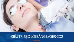 Điều trị sẹo lồi bằng Laser CO2: Hiệu quả hay Hư hỏng?