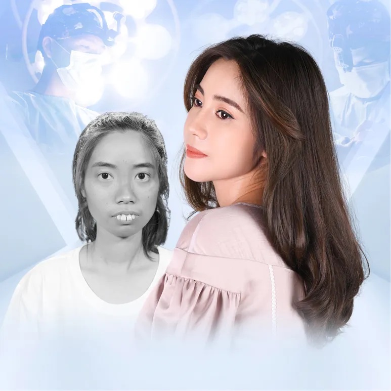 TOP 5 CA “LỘT XÁC” THÀNH CÔNG TẠI BỆNH VIỆN THẨM MỸ KANGNAM