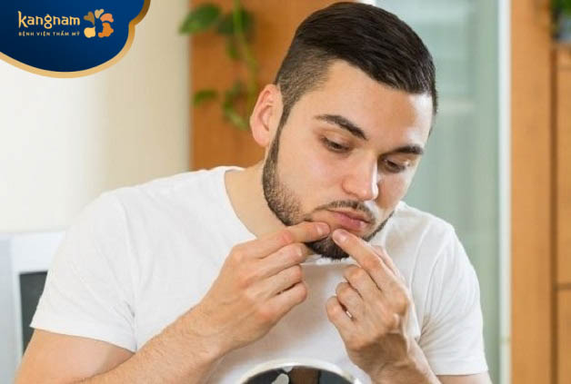 Việc nặn mụn đinh râu quanh miệng có thể gây méo mồm