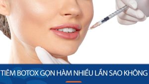 Tiêm botox gọn hàm nhiều lần có sao không? Nên hay không?