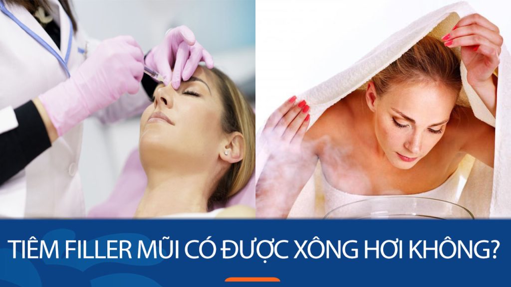 Tiêm filler mũi có được xông hơi không? cần kiêng những gì