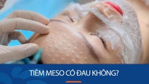 Tiêm meso có đau không? Bí quyết giảm đau khi tiêm meso