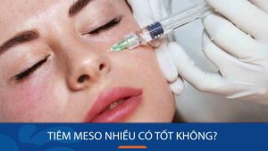 Tiêm meso nhiều có tốt không? Nên tiêm nhiều hay ít để có hiệu quả tốt nhất?