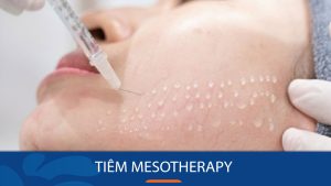 Tiêm Mesotherapy – Bí quyết trẻ hóa da an toàn và hiệu quả