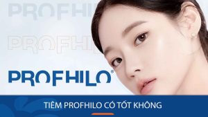 Tiêm Profhilo có tốt không? Review chi tiết từ A đến Z