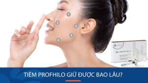 Tiêm profhilo giữ được bao lâu? Tips để duy trì hiệu quả lâu dài