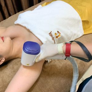 Tại sao nên đi triệt lông? Công nghệ triệt lông nổi bật tại Kangnam