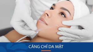 Căng Chỉ Da Mặt – Bí Quyết Trẻ Hóa 10 Tuổi Chỉ Sau 1 Giờ