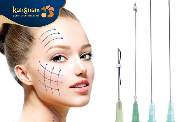 Căng chỉ da mặt có khả năng duy trì hiệu quả trong thời gian từ 3 đến 5 năm