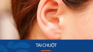 Tướng tai chuột: Liệu có phải khiếm khuyết cần chỉnh sửa?