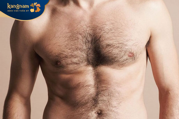 Lông bụng ở nam giới mọc nhiều chủ yếu do nội tiết tố testosterone - hormone sinh dục nam