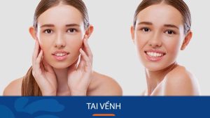 Tai vểnh: Giải mã bí ẩn tướng tai và vận mệnh