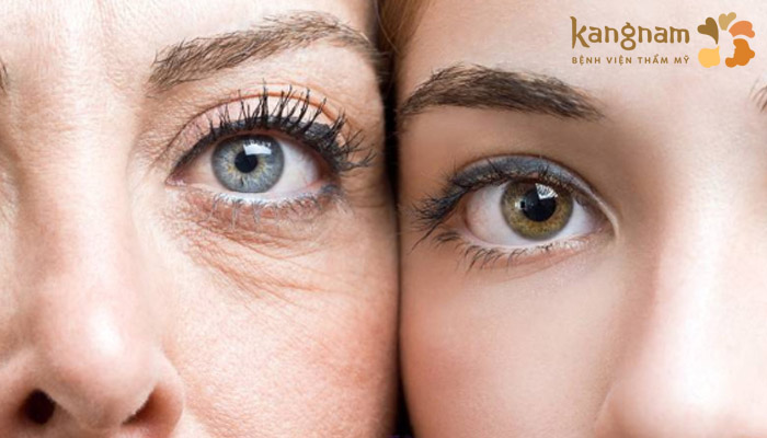 Tuổi tác là một trong những nguyên nhân chính gây lão hóa mắt