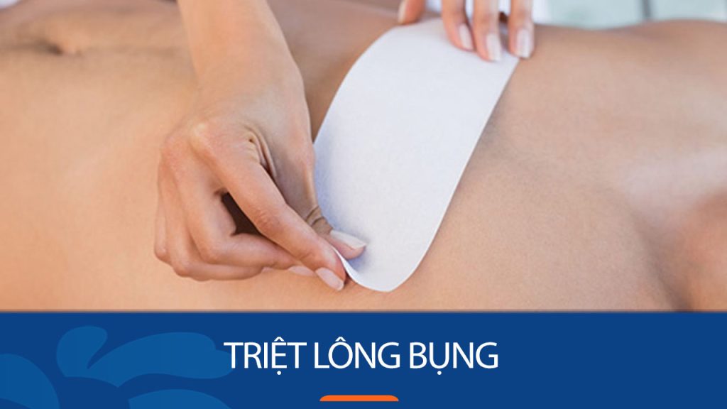 7 Bí quyết triệt lông bụng nhanh, đơn giản – Tự tin khoe dáng
