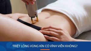 Triệt Lông Vùng Kín Vĩnh Viễn: Giải Đáp Mọi Thắc Mắc!