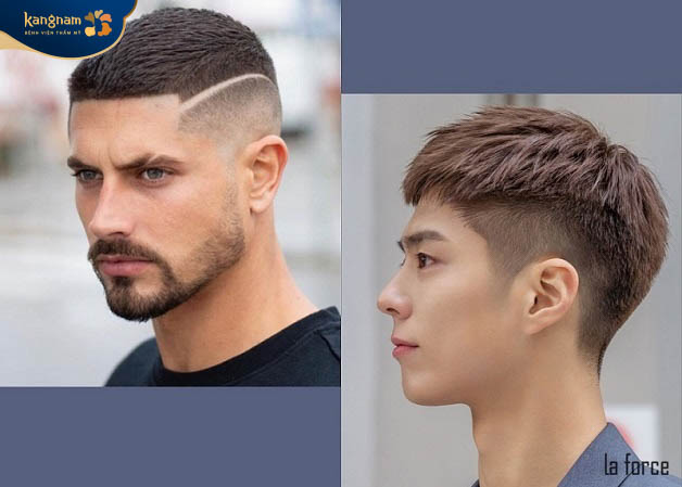 Undercut là lựa chọn hoàn hảo cho quý ông mặt vuông trán ngắn