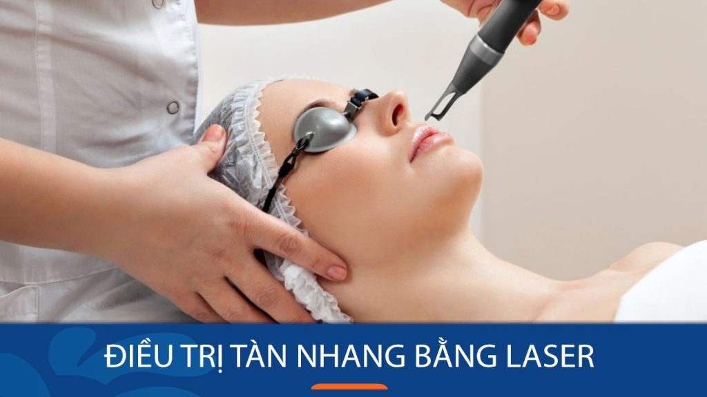 Điều trị tàn nhang bằng laser có hết không? Chuyên gia giải đáp