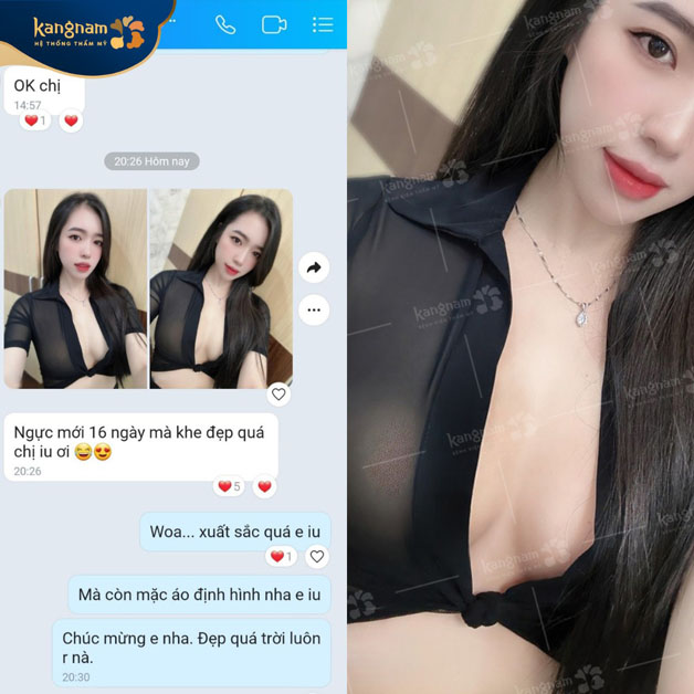 100% khách hàng hài lòng với dịch vụ nâng ngực tại Kangnam