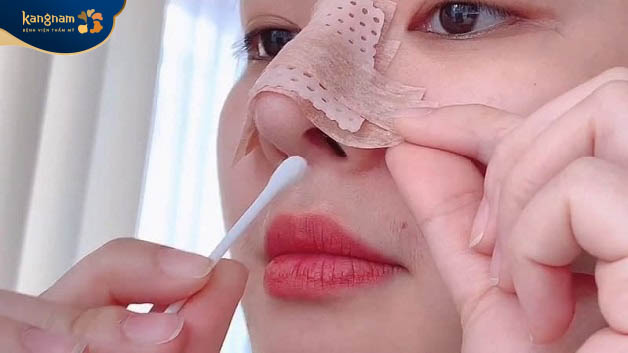 Vệ sinh mũi sạch sẽ giúp vết thương nhanh phục hồi, duy trì hiệu quả lâu dài