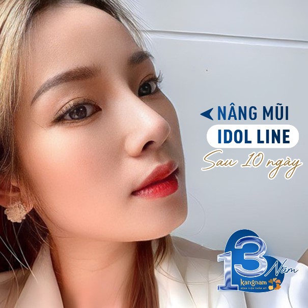 Chị Trang Lương gửi phản hồi sau 10 ngày nâng mũi Idol line