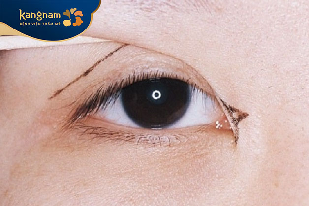 Đôi mắt có phần nếp rẻ quạt lớn khiến mắt trở nên hạn chế