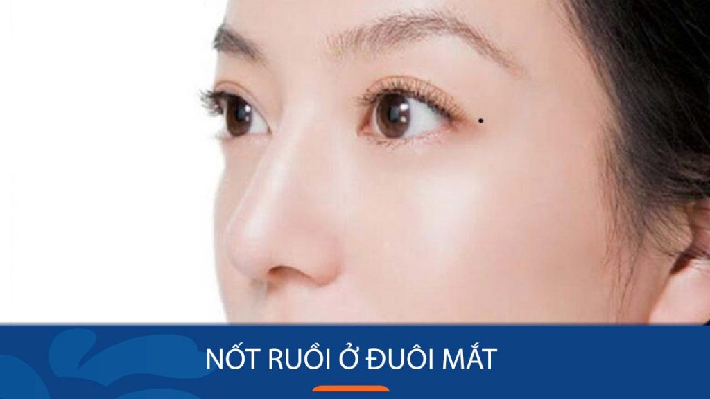 Nốt ruồi ở đuôi mắt nói gì về vận mệnh của bạn?