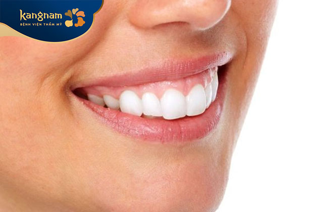 Sau phẫu thuật, cơ môi sẽ giảm độ vén môi quá cao khi cười