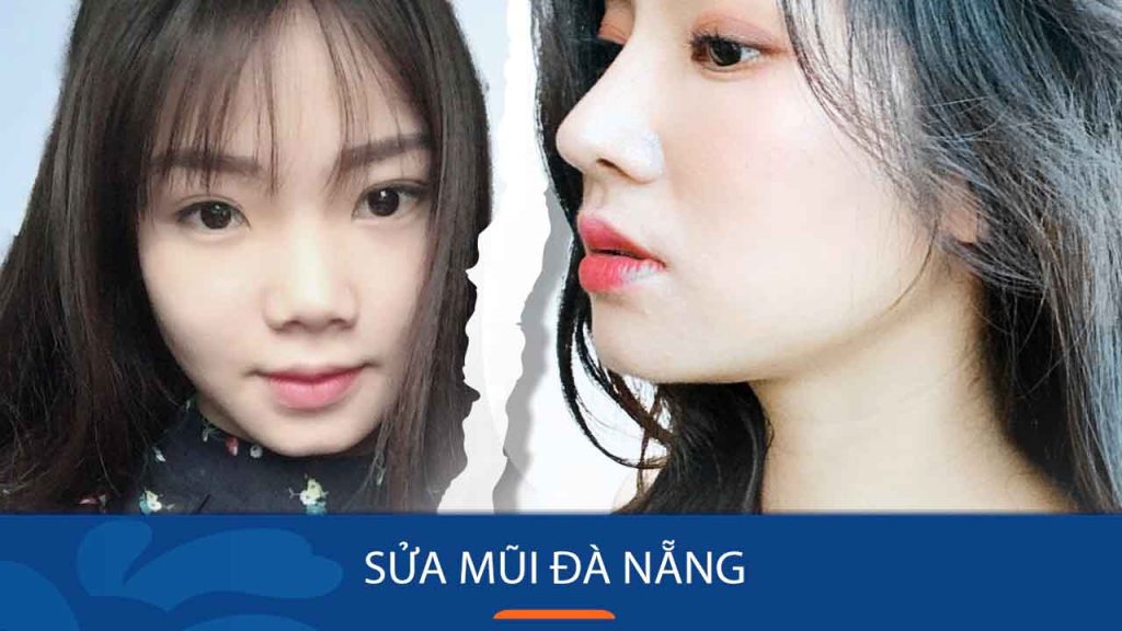 Kangnam – Địa chỉ sửa mũi đà nẵng đẹp đáng tin cậy