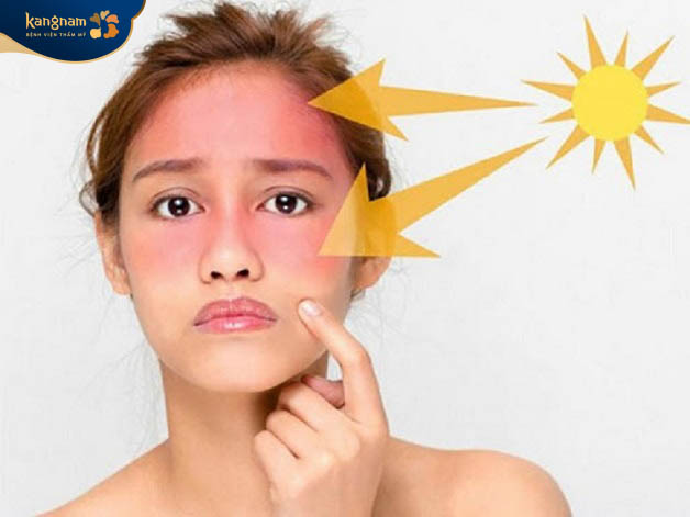 Tia UV trong ánh nắng mặt trời kích thích sản sinh hắc sắc tố