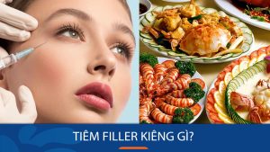 Tiêm filler kiêng gì để đẹp lâu, an toàn?Hướng dẫn chi tiết từ A đến Z