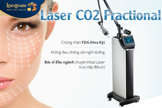 Laser CO2 Fractional trị là phương pháp trị sẹo lồi hiện đại và tiên tiến
