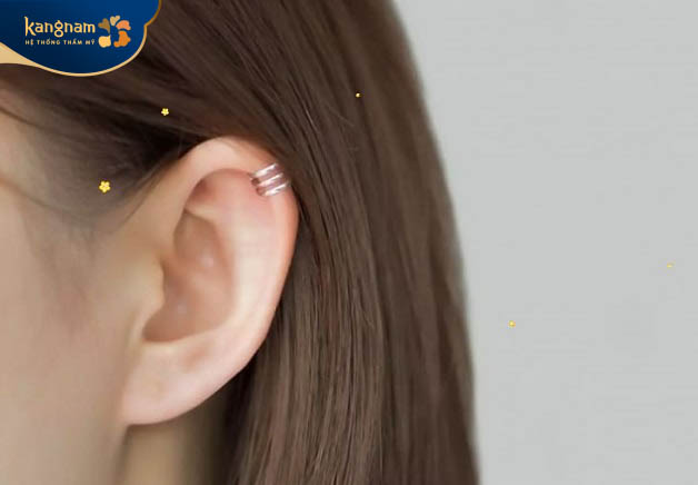 Đa phần những người sở hữu dáng tai này thường lựa chọn phẫu thuật thay đổi dáng tai
