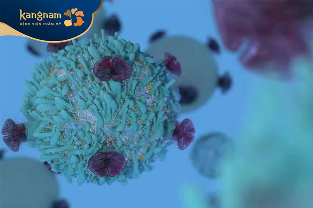 Ung thư hạch tế bào lớn bất sản liên quan tới túi ngực