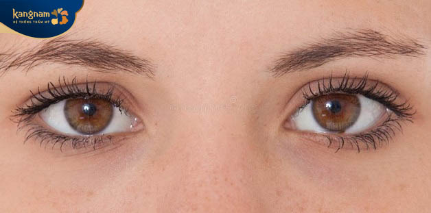 Chỉ khoảng 5% dân số sở hữu đôi mắt màu hạt dẻ