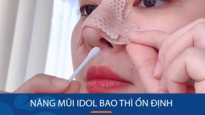 Nâng mũi Idol bao lâu thì ổn định? Bí quyết hồi phục nhanh chóng