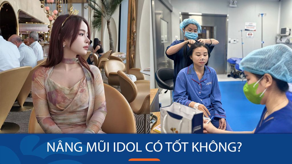 Nâng mũi Idol có tốt không? Đánh giá chi tiết ưu nhược điểm