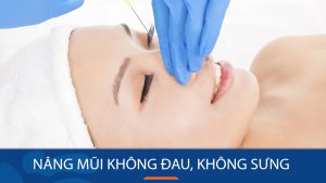 Nâng mũi không đau, không sưng: Nâng mũi không phẫu thuật