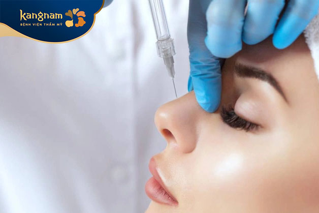 Các phương pháp như căng chỉ mũi, tiêm filler mũi không cần thời gian nghỉ dưỡng