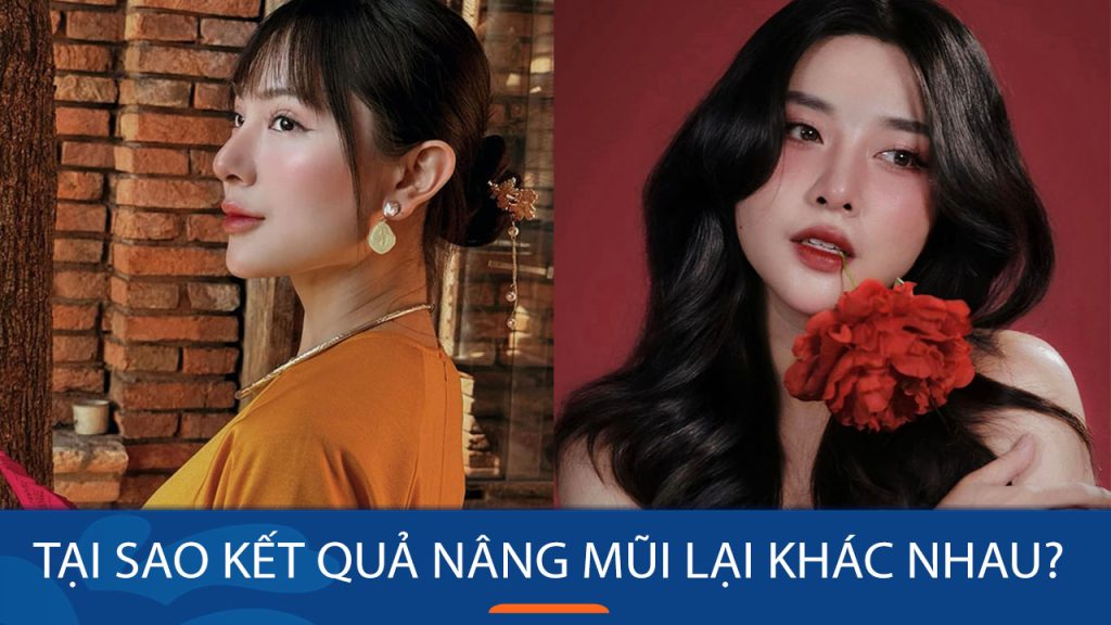 Tại sao kết quả nâng mũi lại khác nhau ở mỗi người?