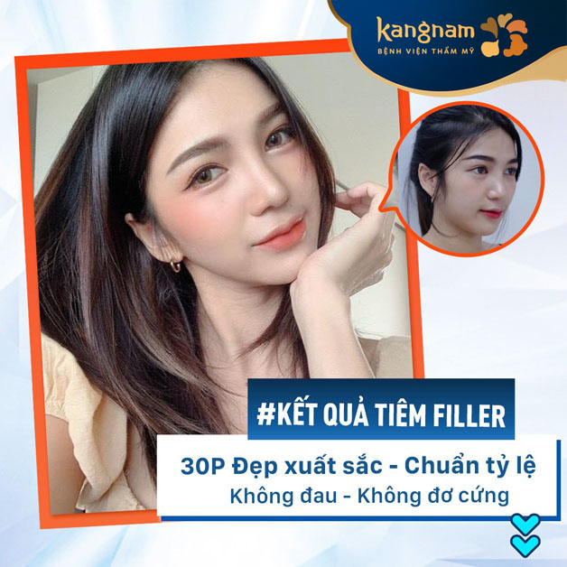 Mũi cao thẳng và tự nhiên, không đơ cứng